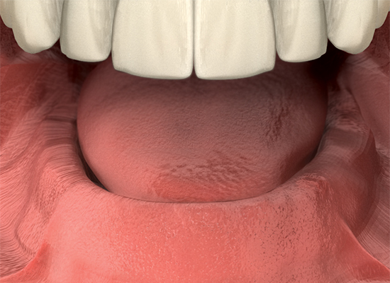 ImplantsA